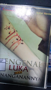 Image of MENGENAL LUKA DAN PENANGANANNYA
